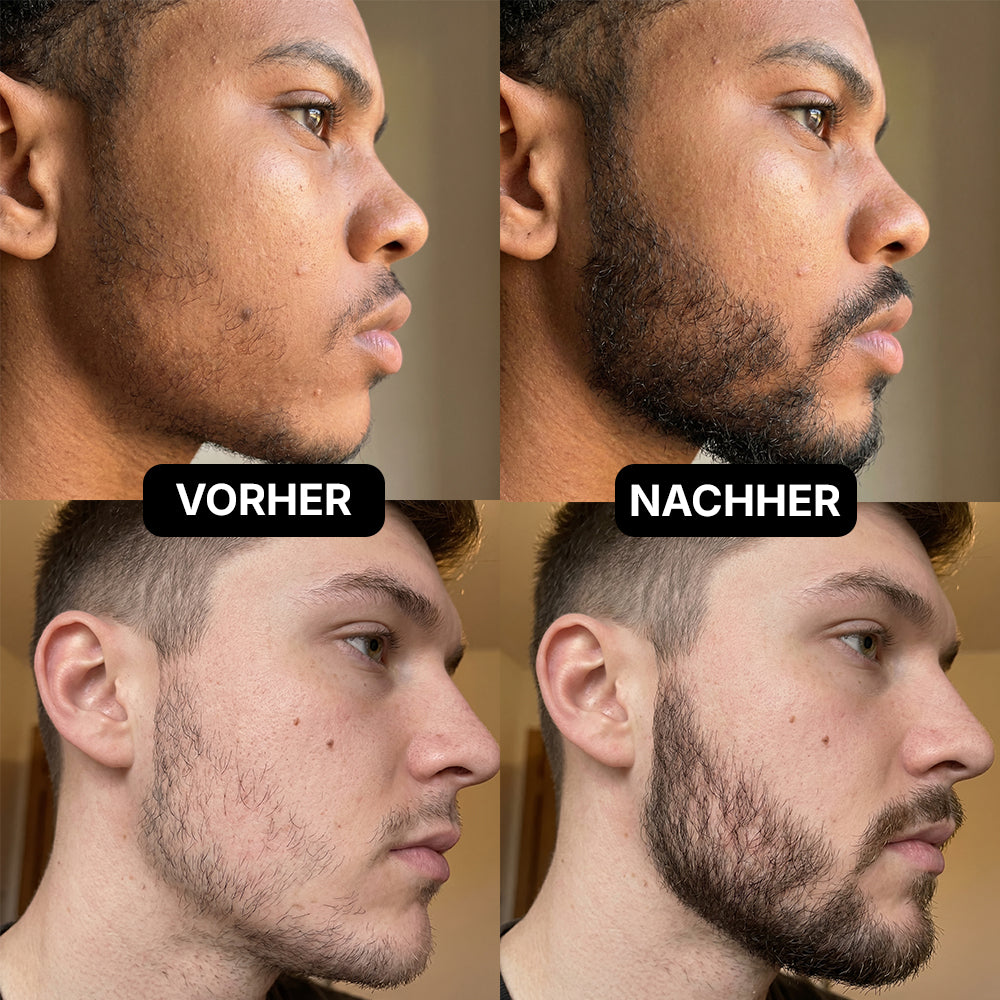 Beardlab™ - Beard Growth Kit | Voller Bart in 9 Wochen!